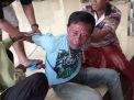 Takut Dihajar Masa, Maling Sepeda Angin Pasang Wajah Melas Saat Tertangkap