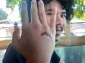Jurnalis detikcom Dikeroyok, Polisi Ungkap Modus Pelaku