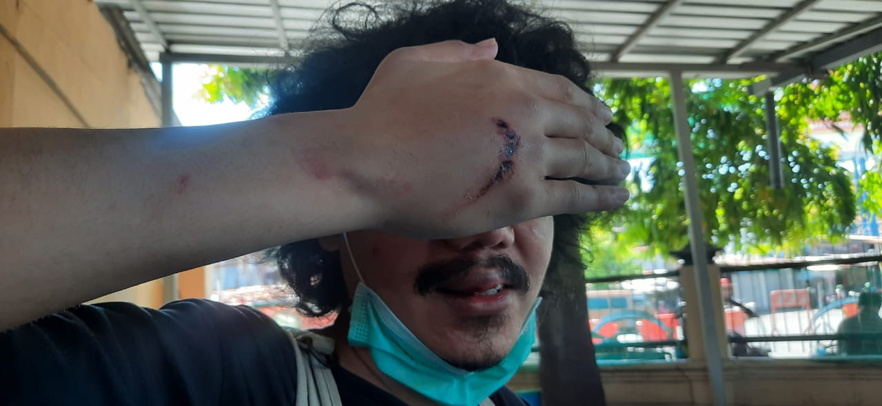 Jurnalis detikcom Dikeroyok 4 Pria Diduga Pelaku Begal di Surabaya