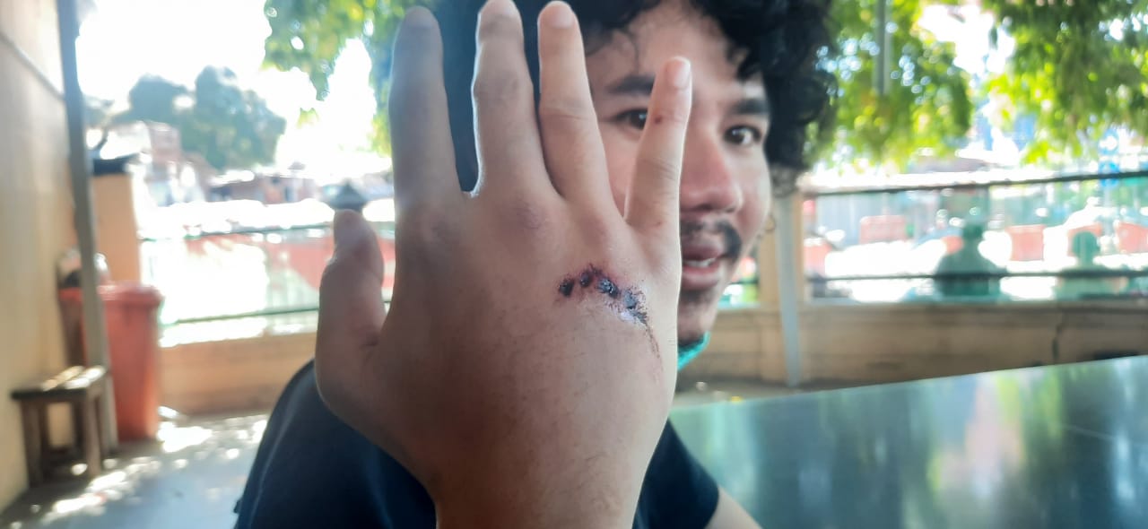 Pelaku Pengeroyok Editor detikcom Belum Tertangkap, Ini Alasan Polisi