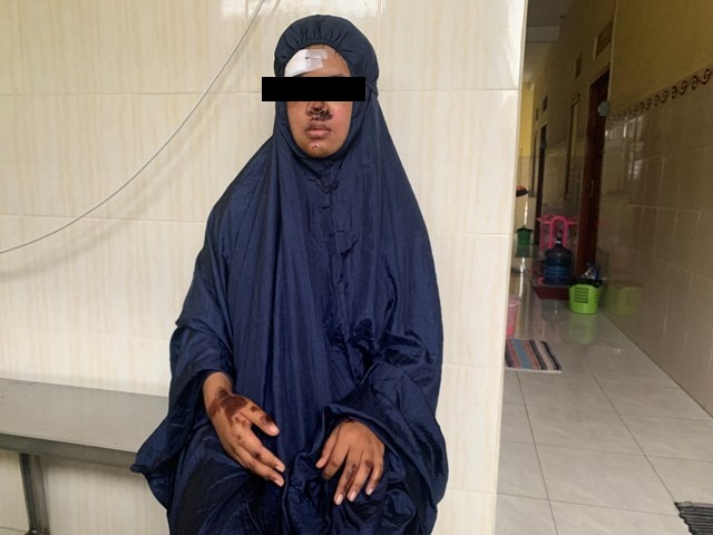 Begini Kronologi Lengkap Gadis yang Jadi Korban Keganasan Pemuda Mabuk
