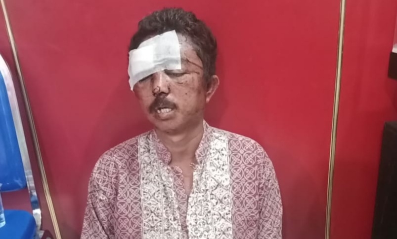 Pelaku Curanmor yang Dihajar Massa Siuman, Polisi: Dia Residivis