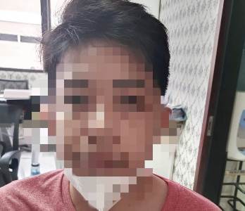 Ngaku Dokter, Istri Orang "Ditiduri" Lalu Ancam Sebar Foto Telanjang