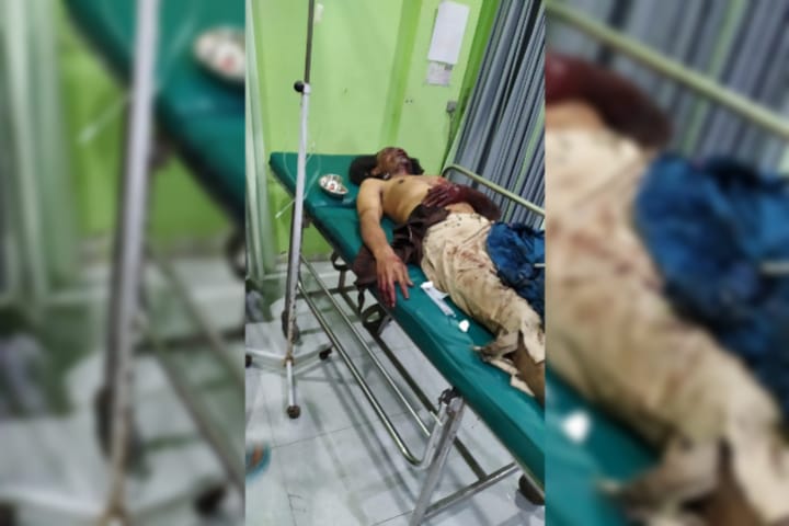 Asyik Merakit Mercon, Satu Warga di Jombang Tewas Terkena Ledakan