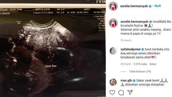 Diduga Kelelahan, Aurel Hermansyah Keguguran