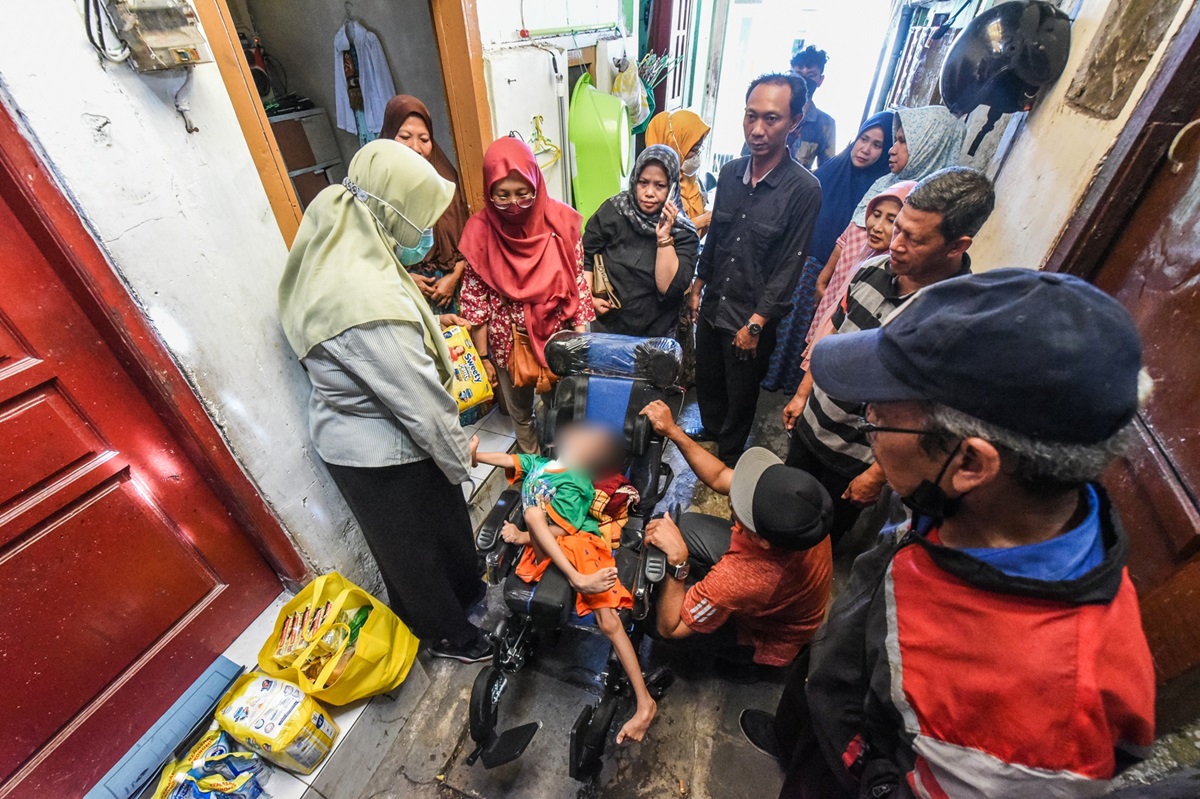 Pemkot Surabaya Bantu Anak Penderita Cerebral Palsy di Dinoyo